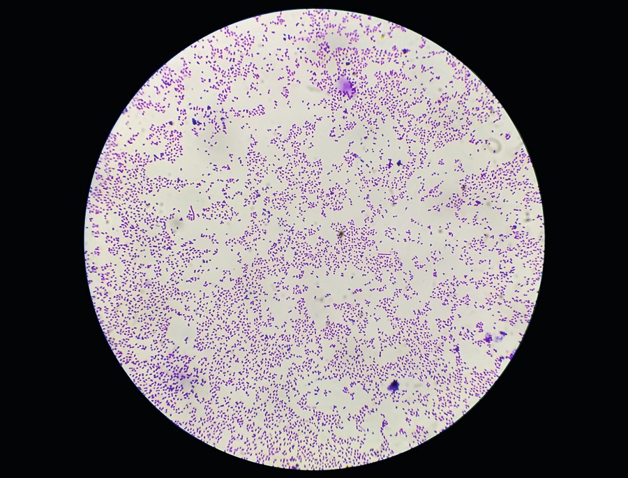Staphylococcus aureus-Bakterien adobestock_486407175.jpg