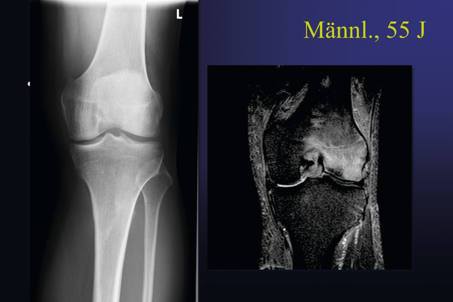 arthrose_abb_2.jpg arthrose_abb_2.jpg